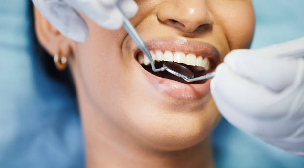 Best Emergency Tooth Extraction in Albion, IN