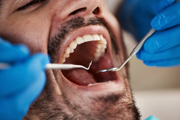 Best After-Hours Dental Trauma Care in Albion, IN